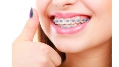 Aparat stały Damon Q - Poznaj jego zalety!