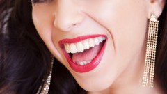 Odpowiadamy na częste pytania dotyczące noszenia aparatu ortodontycznego