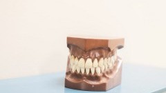 Protetyka stomatologiczna