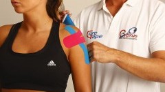 Kinesiotaping - innowacyjna metoda czy zwykłe placebo?