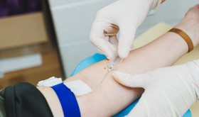 Jak przygotować się do badania krwi na boreliozę?