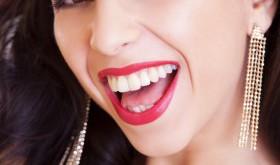 Odpowiadamy na częste pytania dotyczące noszenia aparatu ortodontycznego