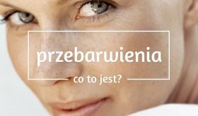 Przebarwienia - pamiątka po wakacjach