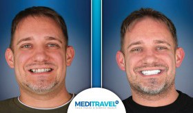 Turyści z Polski wracają nie tylko opaleni – ale i z nowym uśmiechem