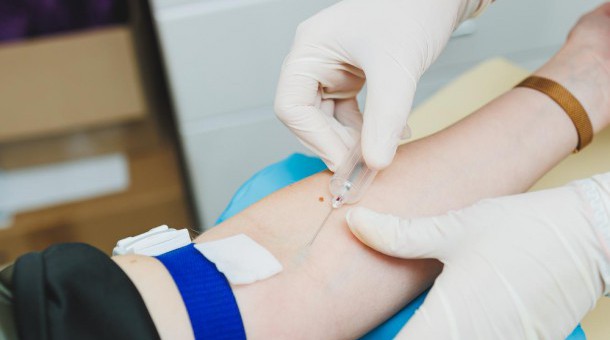 Jak przygotować się do badania krwi na boreliozę?